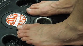 Metatarsalgia- Ball Of Foot Pain