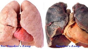 Cigarette Smoking & The Effects On Your Fitness Goals!