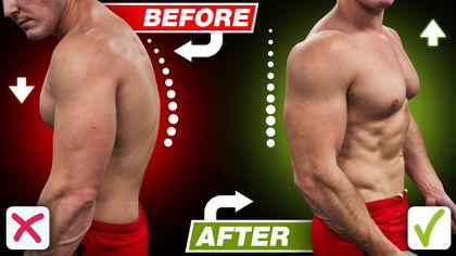 Have Bad Posture? Fix Your "Hunchback" Now!